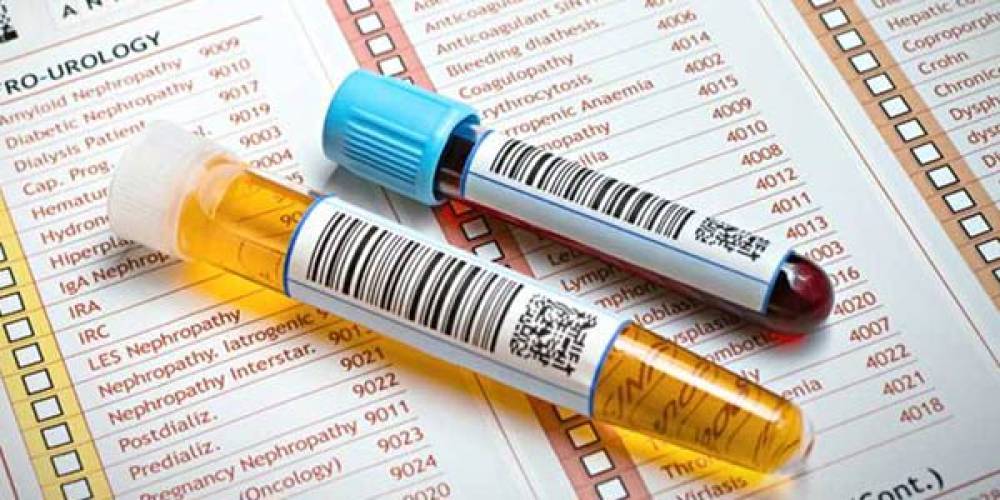 برنامه آزمایشات تخصصی