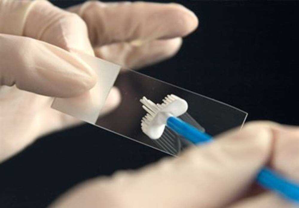 اهمیت تست hpv بر روی نمونه پاپ اسمیر