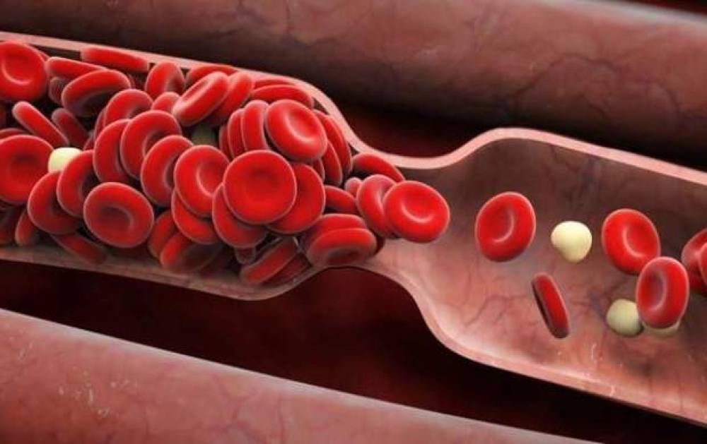آمادگی برای آزمایشات انعقادی