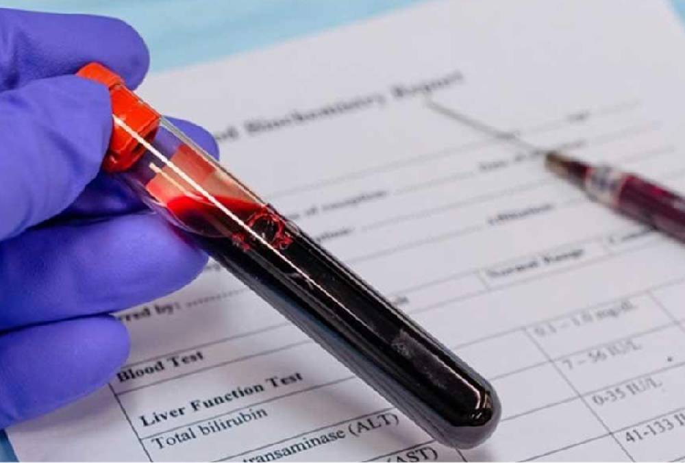 آمادگی قبل از آزمایش