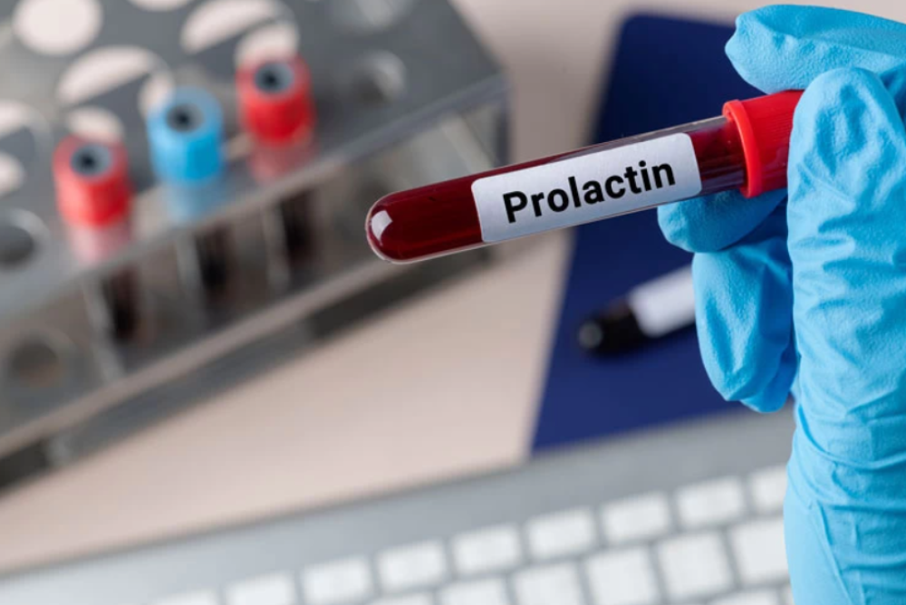 آزمایش پرولاکتین خون و علل بهم ریختن سطح آن